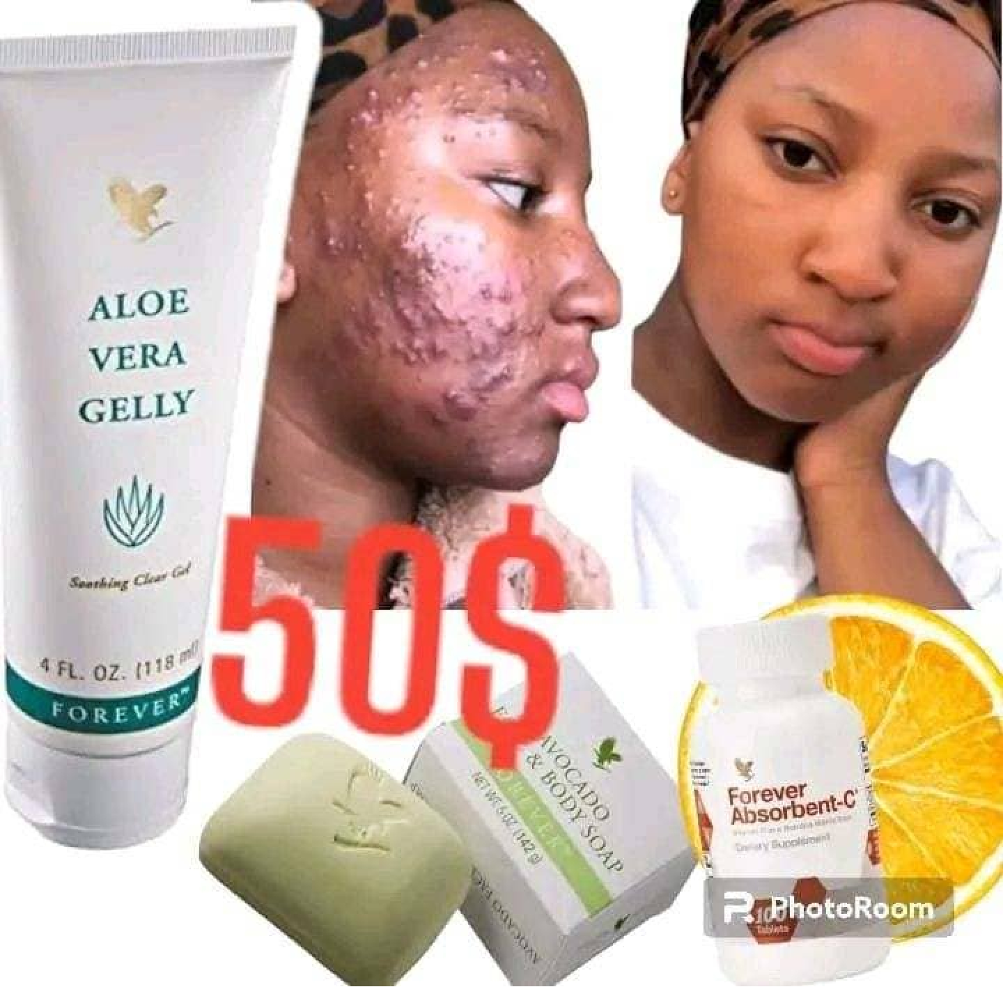 ALOE VERA GellY