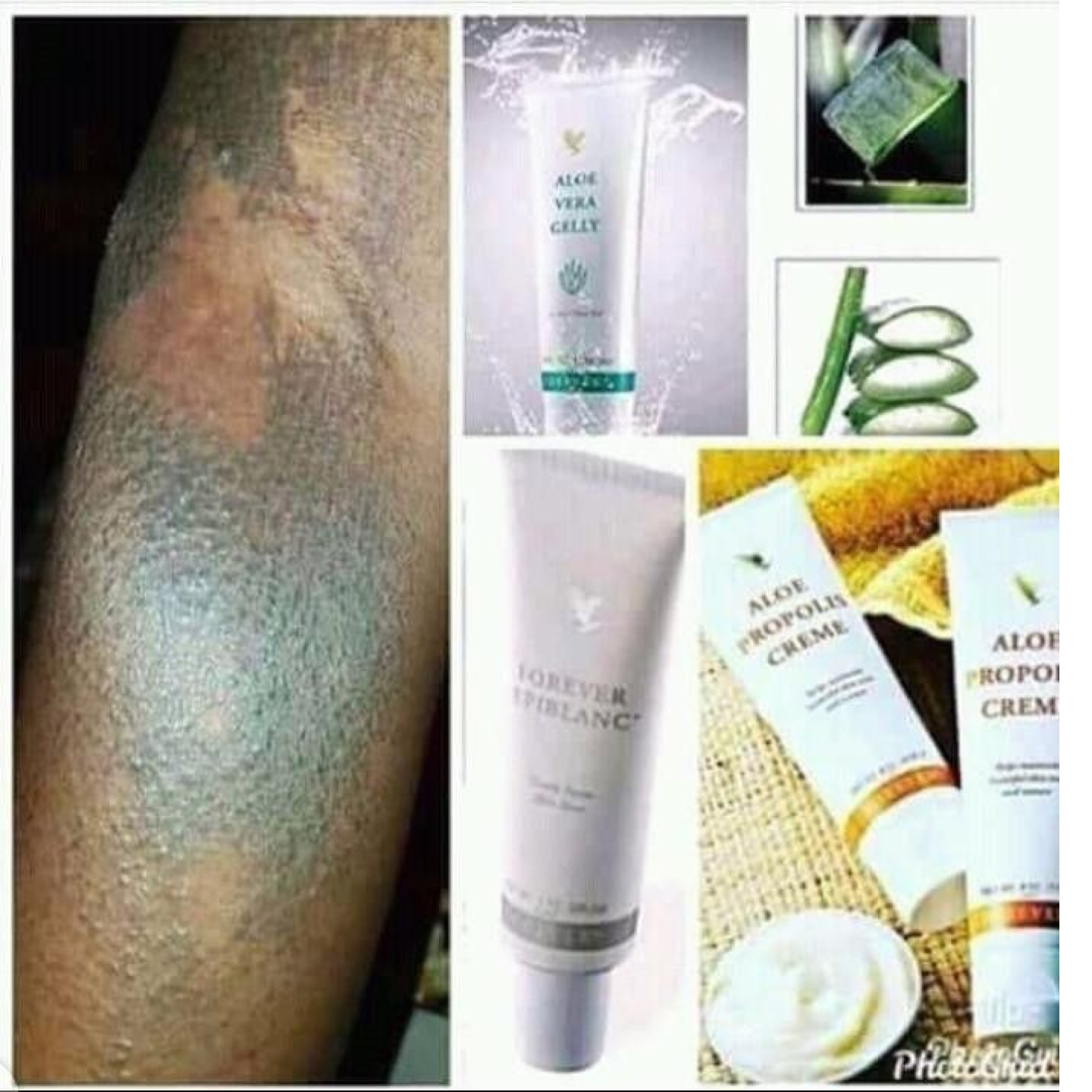 ALOE VERA GellY